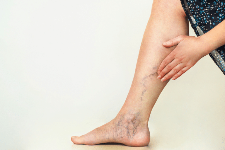 Enfermedad Arterial y Enfermedad Venosa | Causas y tratamientos