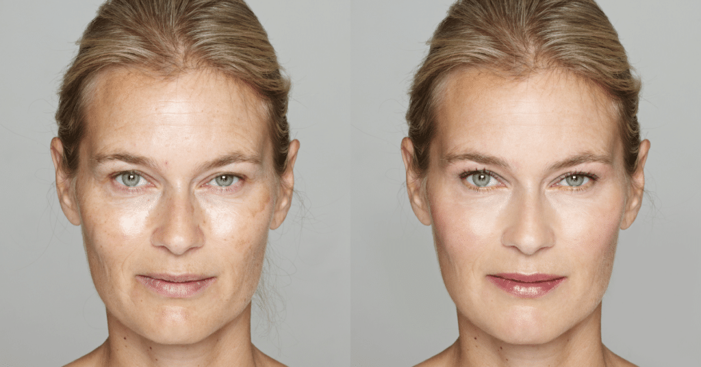 Moms Rejoice Mommy Makeover: Full Body and Face Procedures