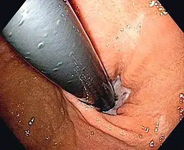 ESA