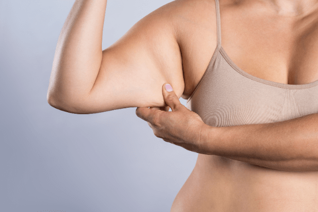 Bariatric Surgery and Skin Sagging