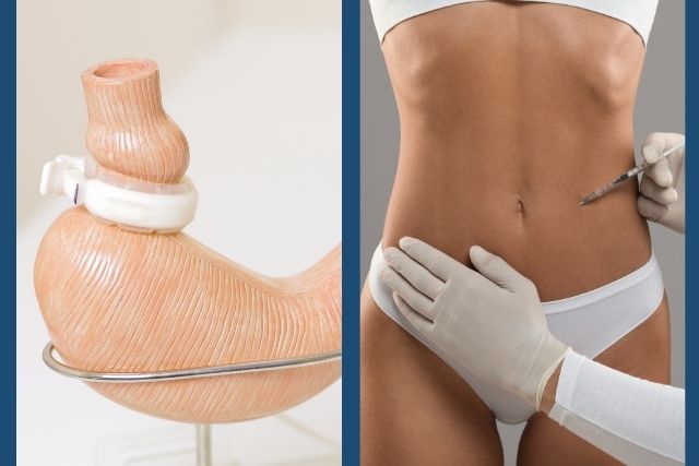 Mommy makeover after bariatric surgery