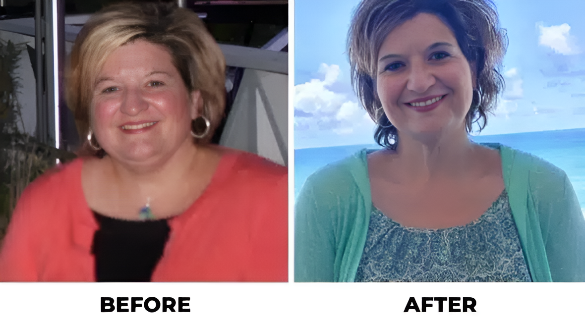 Before and After - Success Stories