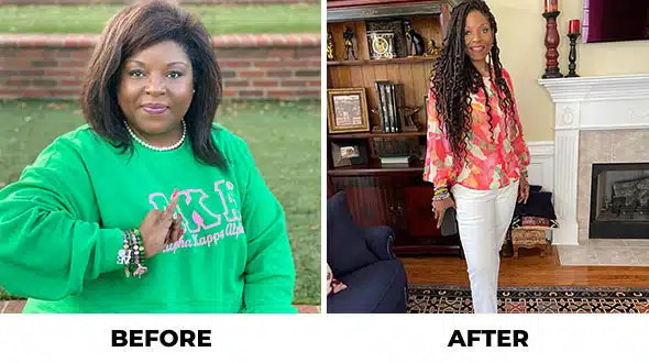 Before and After