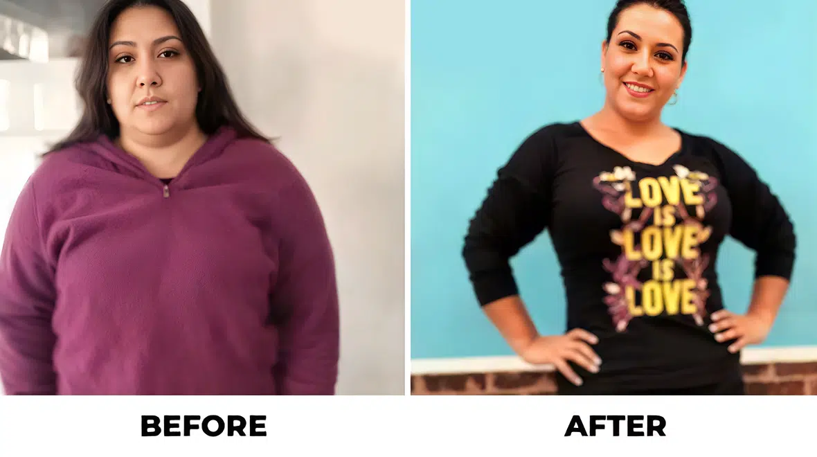 Before and After - Success Stories