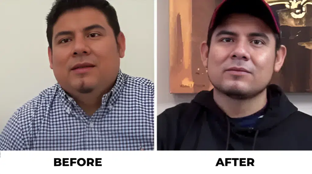 Before and After - Success Stories - ESG