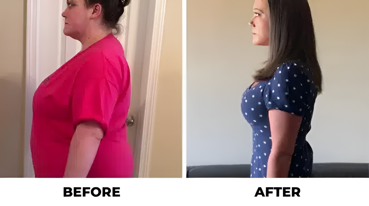Before and After - Success Stories