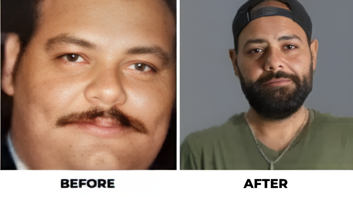 Before and After - LSG