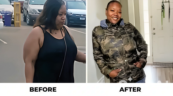 Before and After - Success Stories