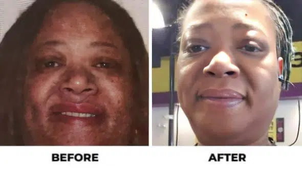 Before and After - Success Stories - LSG
