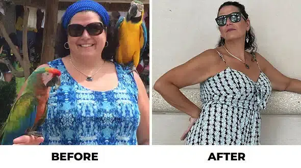 Before and After - Success Stories