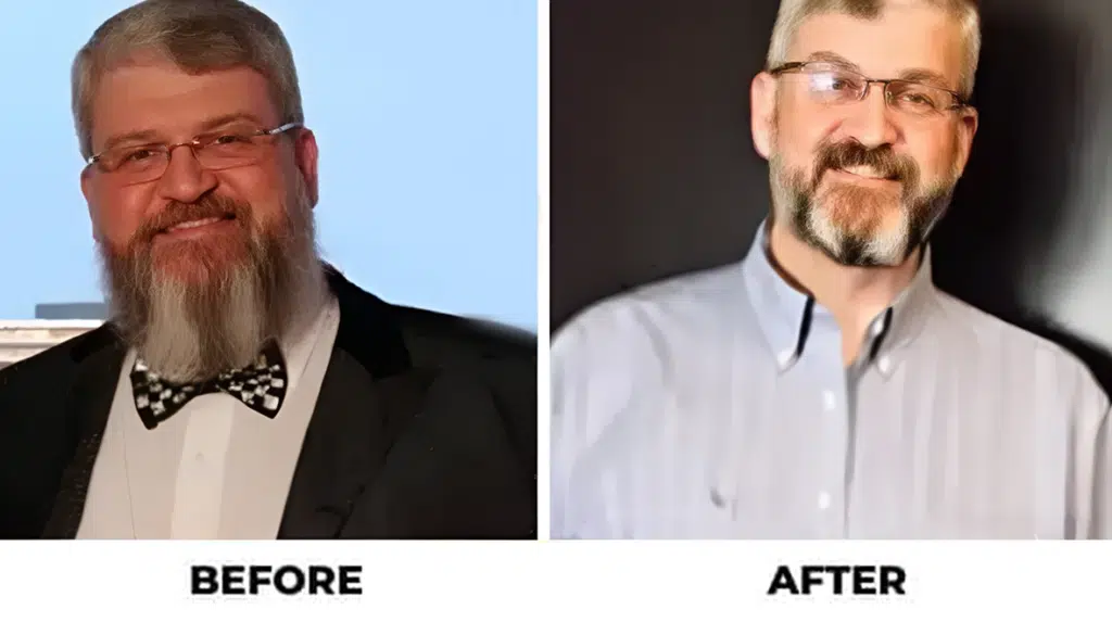 Before and After - Success Stories