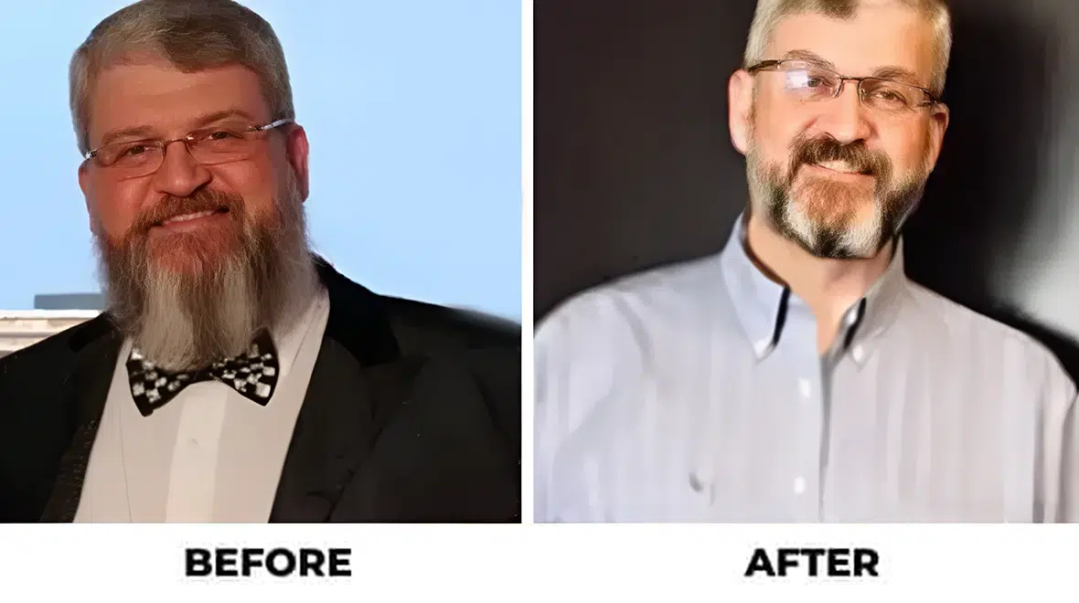 Before and After - Success Stories