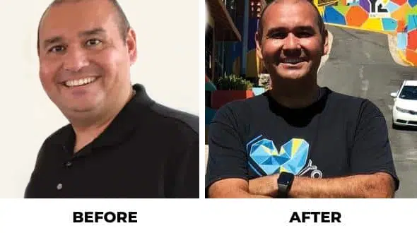 Before and After - Success Stories