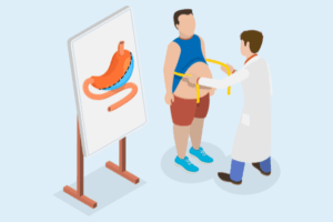 Bariatric Surgery Requirements