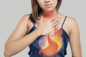 What Is Acid Reflux?