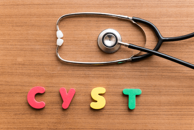 Pilonidal Cyst